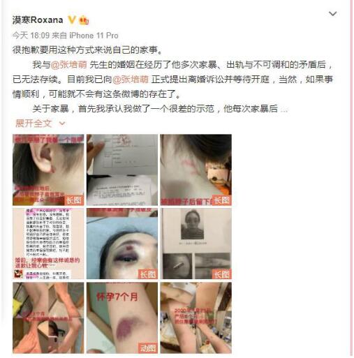 剧情反转！张培萌妻子称只想要女儿抚养权 张培萌婚内出轨抢孩子