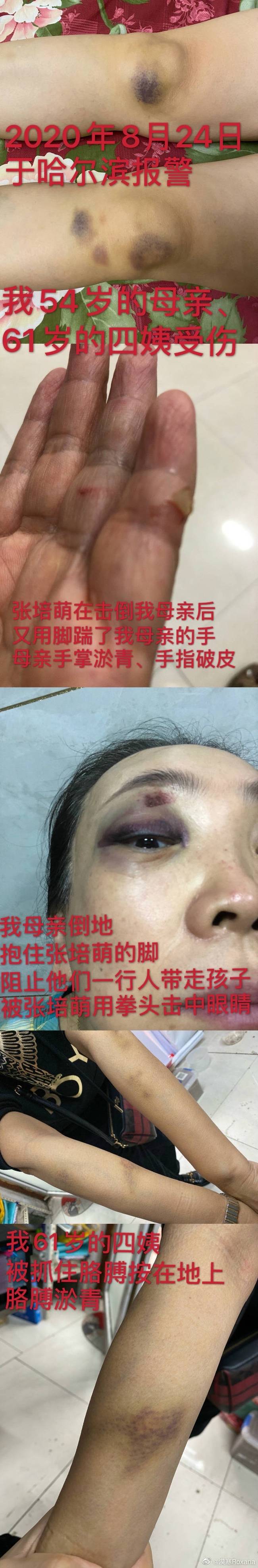 剧情反转！张培萌妻子称只想要女儿抚养权 张培萌婚内出轨抢孩子