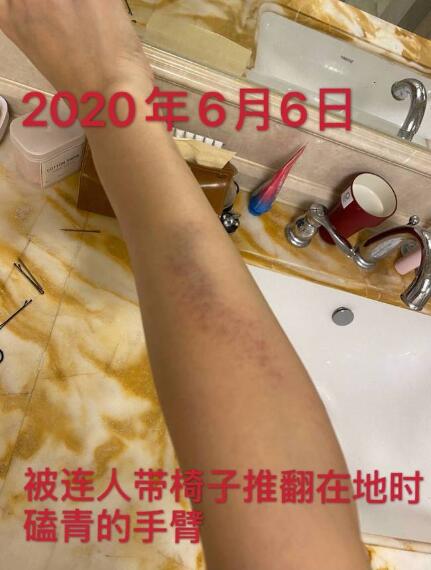 剧情反转！张培萌妻子称只想要女儿抚养权 张培萌婚内出轨抢孩子