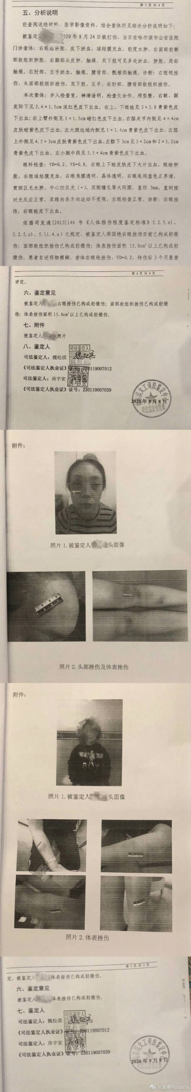 剧情反转！张培萌妻子称只想要女儿抚养权 张培萌婚内出轨抢孩子
