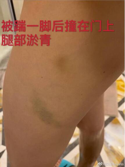 剧情反转！张培萌妻子称只想要女儿抚养权 张培萌婚内出轨抢孩子