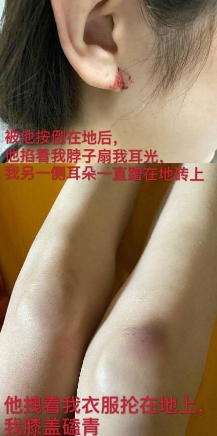 剧情反转！张培萌妻子称只想要女儿抚养权 张培萌婚内出轨抢孩子